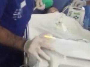 Após cirurgia de separação, gêmeos seguem em estado grave em hospital