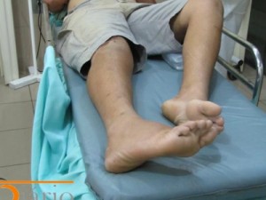 Barbalha-CE Homem é lesionado a golpes de foice