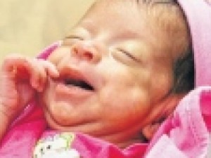 Ceará possui a menor taxa de óbitos do NE