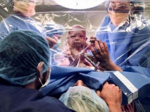 Cortina transparente agora permite que mães vejam o bebê na cesárea