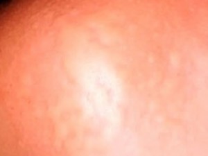 Doença sem diagnóstico assusta moradores de Camaçari: 'angustiante'