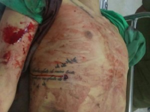 Elemento desobedece a PM, troca tiros e morre na UPA