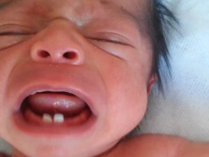 Em caso raro, bebê nasce com dois dentes e surpreende pais em Sorocaba