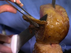 Entenda a relação da gordura que está na alimentação com o coração