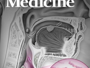 Exame de sangue e saliva é eficaz na detecção da maioria de cânceres orais