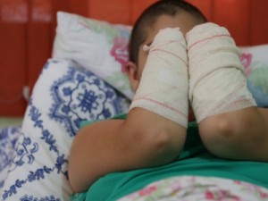 Festival no RS tenta arrecadar fundos para jovem que teve mãos decepadas