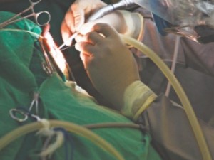 Fraude de recibos pode chegar a R$ 11 milhões