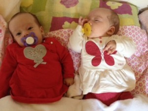 Gêmeas brasileiras nascem com cordões umbilicais entrelaçados