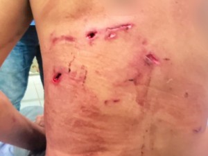 Homem atacado por onça-pintada é salvo por 5 cachorros em MS