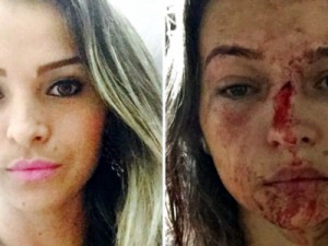 'Implorei que parasse', diz jovem agredida por lutador de MMA no Acre