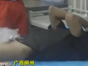 Jovem fica com o pênis entalado em aliança de casamento por dois dias