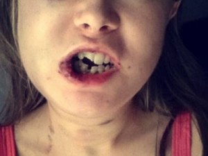 Jovem posta alerta sobre ex-companheiro que a agrediu após negar sexo: 'Monstro'; imagens fortes