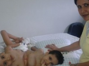 Mãe diz que gêmeo separado mandou beijo para irmão após acordar