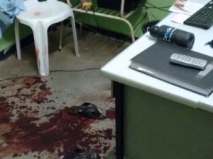 Missão Velha-CE Policial alvejado a bala em resgate de preso