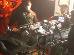 Morre criança que teve 95% do corpo queimado dentro de casa em Tianguá