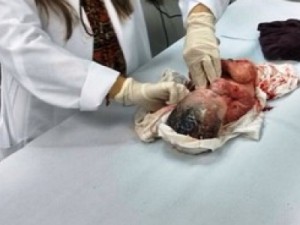 Mulher dá à luz no meio da rua e abandona o filho no litoral de SP