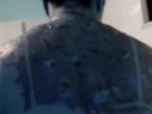 Mulher é agredida com água fervente e tem queimaduras de 2º grau no CE