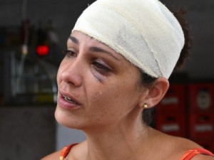 Mulher é agredida com remo pelo marido: 'quem bate não tem amor'