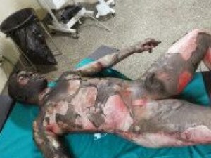 Mulher matar marido e amante com gasolina e fogo, em Fortaleza