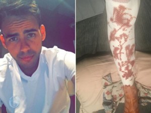 'Não tinha mais vaga nos hospitais', diz brasileiro ferido em ataque de Nice