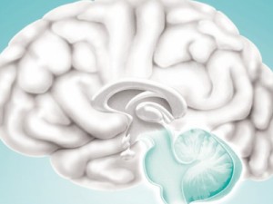 Os sinais prematuros do Parkinson