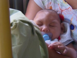 Pernambuco confirma 215 dos 1.672 casos de microcefalia notificados