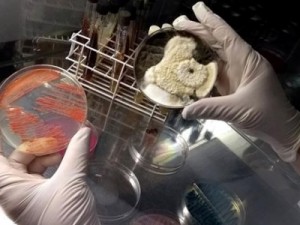 Pesquisa em roupas íntimas encontra 10 mil bactérias e fungos