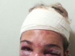 Polícia procura grupo que agrediu jovem por homofobia em Juiz de Fora