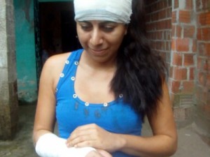 Raio destrói telhado de residência em Fortaleza e fere mulher na cabeça