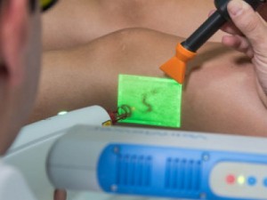 Varizes: além de estética, problema afeta qualidade de vida