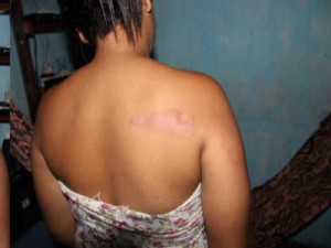 Vereador não correspondido em assédio é acusado de tentar matar menor de idade em São João do Arraial