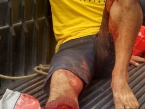 Violência na antevéspera do Natal registra 10 casos de assassinatos no Ceará