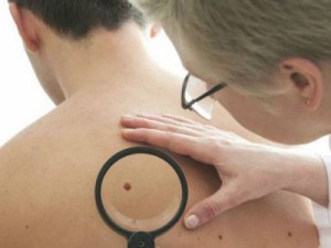 Vírus da herpes pode curar câncer de pele, dizem cientistas