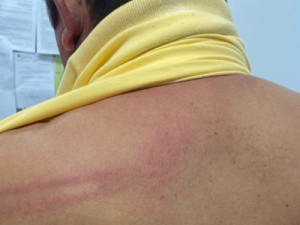 Prefeito de Palhano é agredido por policiais militares durante festa de Carnaval na cidade