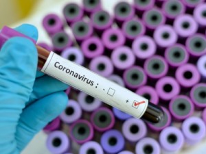 Ceará está em condição de aceleração de transmissão do coronavírus, diz MS