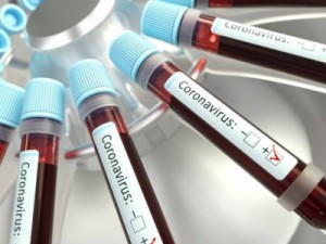 Ceará chega a 35 mortos pela covid 19; diagnósticos positivos passam de 1.050