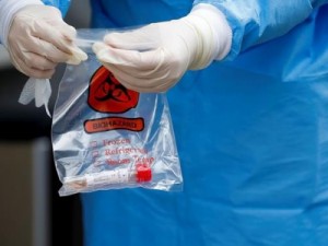 Barbalha-CE Segundo caso de coronavírus confirmado positivo