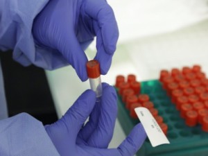 Ceará abre chamamento público para realização de 480 mil testes de Covid-19 em quatro meses