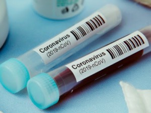 Coronavírus – Barbalha à um caso para 400 notificados