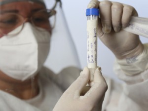 Pesquisa de Soroprevalência iniciada em Sobral realizará 2400 exames