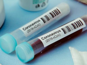 Barbalha, Crato e Juazeiro já tem mais de 5 mil casos confirmados de coronavírus