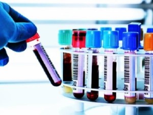 Barbalha mais de 600 casos de Covid-19, veja também Crato, Juazeiro, Ceará e Brasil