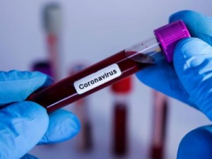 Barbalha registra mais óbitos, e mais de 80 casos confirmados por coronavírus