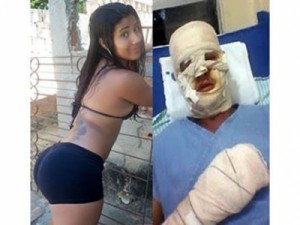 TRAGÉDIA: Mulher toca fogo no namorado por ele preferir vídeos adultos em vez dela