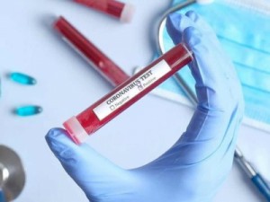 Brasil chega a 31 dias com média móvel acima de 1 mil mortos por Covid; total alcança 246 mil