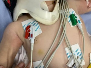 Médica chama a polícia após atender bebê com mais de 30 lesões no corpo, em Anápolis