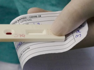 No Ceará, parceria entre Hemoce e Fiocruz realizou mais 50 mil testes de Covid-19