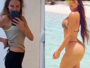 Luciana Gimenez destaca resultado de procedimento: "Bundinha da Kim Kardashian"