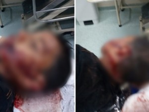 Delegada fala sobre caso de menino autista torturado e espancado: 'Um dos mais cruéis em toda carreira'