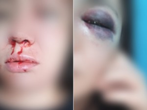 Jovem de 25 anos com medida protetiva denuncia que foi espancada pelo ex dentro da casa da mãe